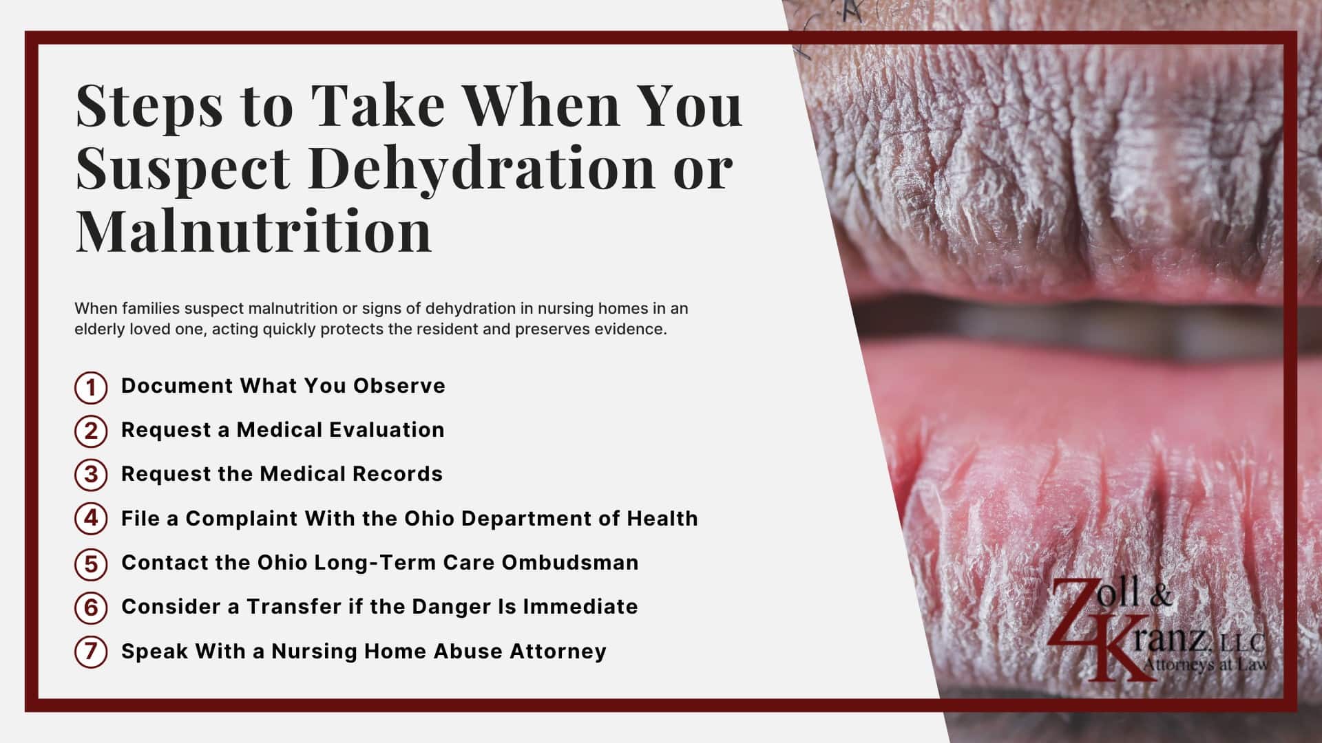 Steps to Take When You Suspect Dehydration or Malnutrition; Federal and Ohio Standards for Nutrition and Hydration; Serious Health Complications From Dehydration and Malnutrition; Common Causes of Dehydration and Malnutrition in Nursing Homes; Warning Signs of Malnutrition in Nursing Home Residents; Warning Signs of Dehydration in Nursing Home Residents; Who Can Report Nursing Home Abuse