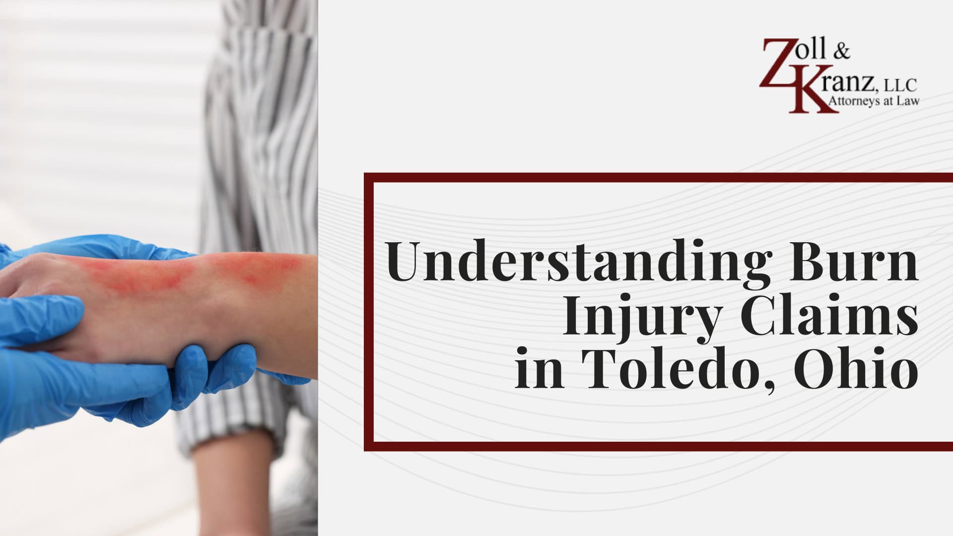 Understanding Burn Injury Claims in Toledo, Ohio